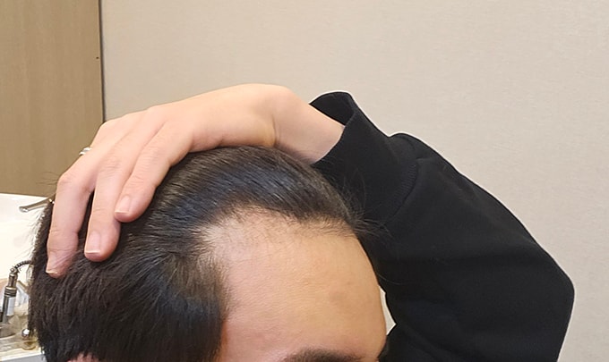 4. 암흑기 잘이겨내면 이식모 쑥쑥 올라올거라고 정신승리중.jpg