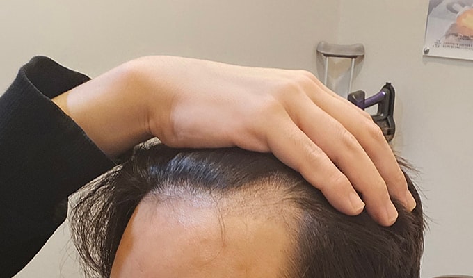 5. 암흑기 쎄게 왔슴더....jpg