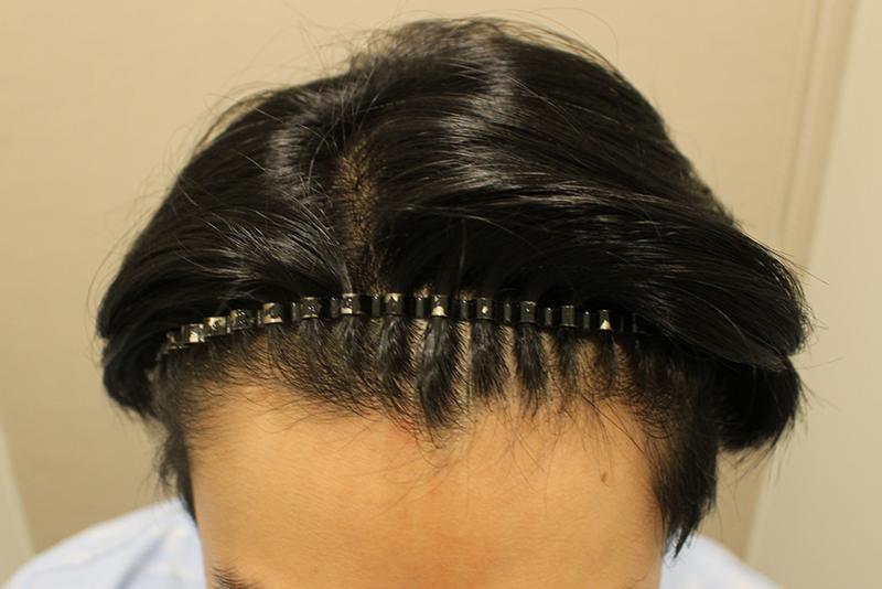 ヘアライン+窯、望むところだけ集中的に密度を強化しました！