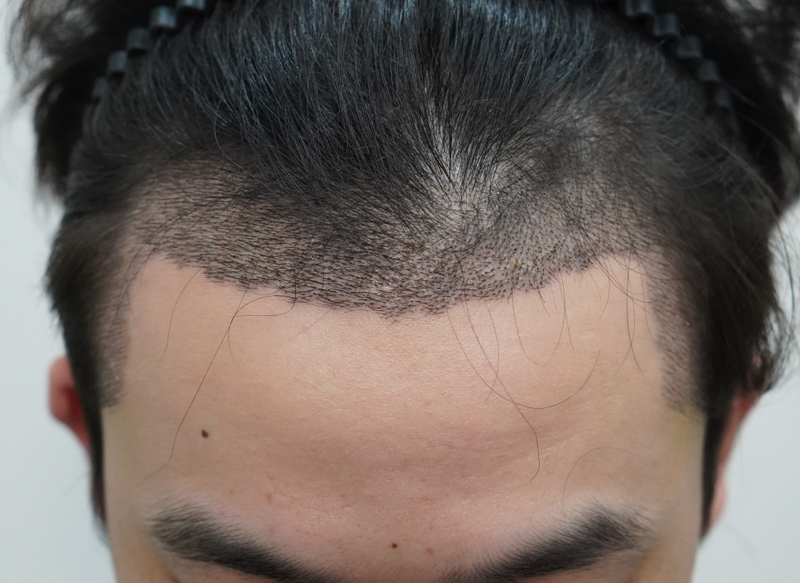 4.png