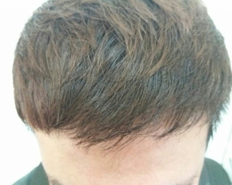 후1.jpg