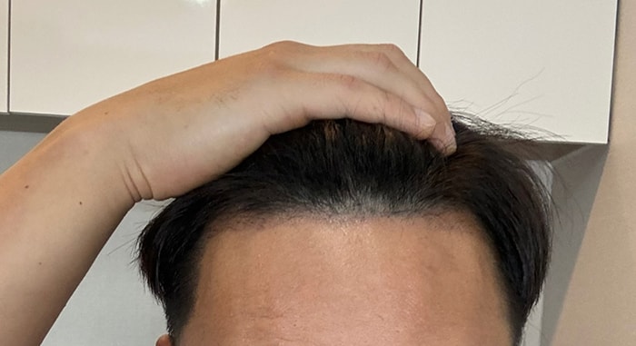 3 암흑기.jpg