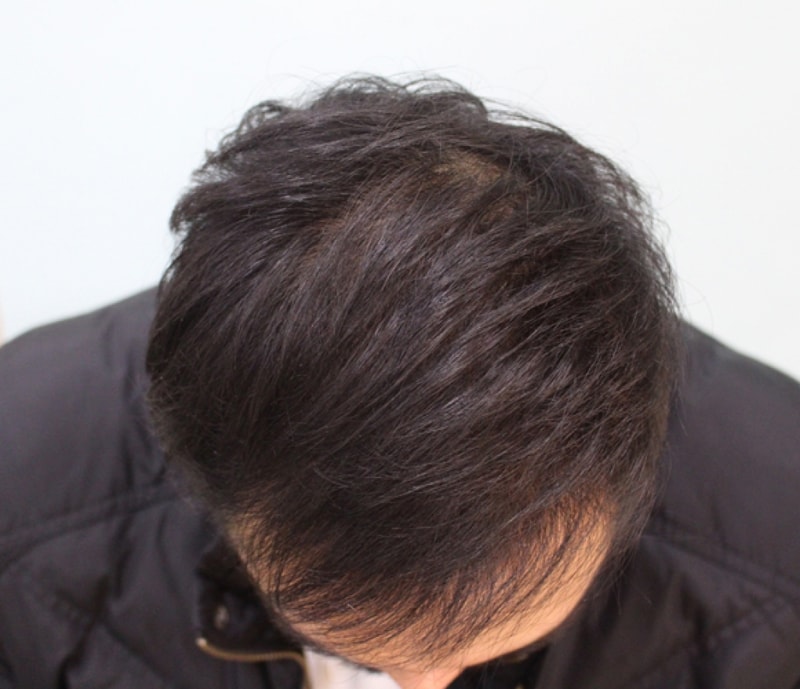 1수술후.jpg
