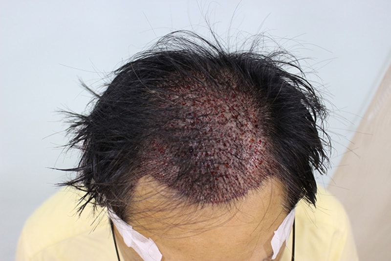 수술후(9).JPG