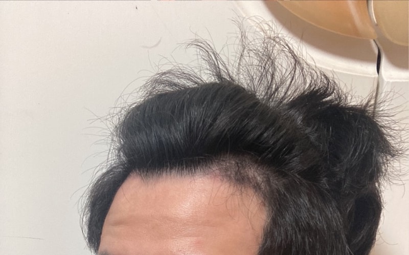 無削髪3ヶ月経過後記
