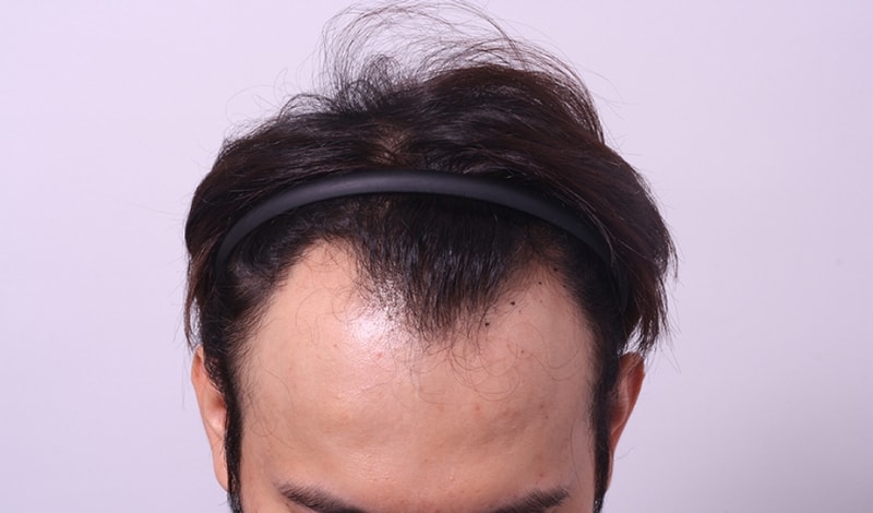 수술전1.jpg