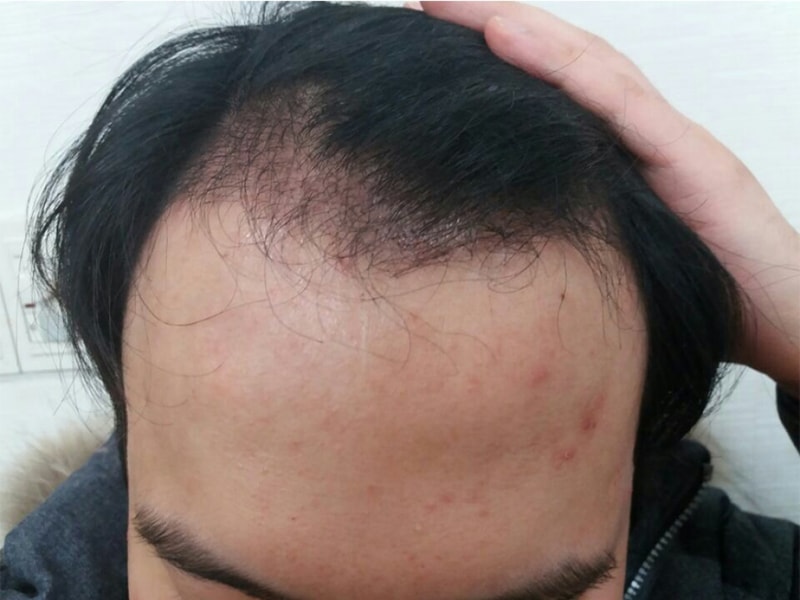 수술후2.jpg