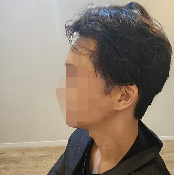 10-2800모는 부분삭발 1000모는 무삭발로 해서 뒷머리 티가 거의 안나요.jpg