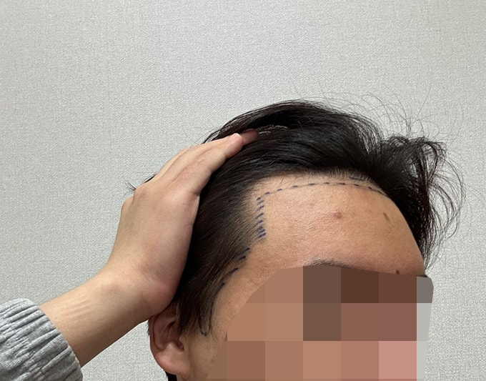 3-디자인후.jpg