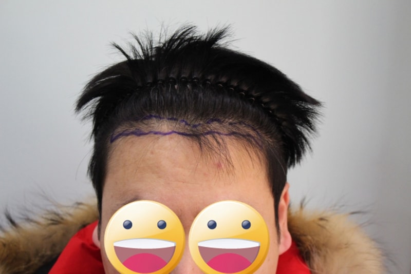 수술전3.jpg