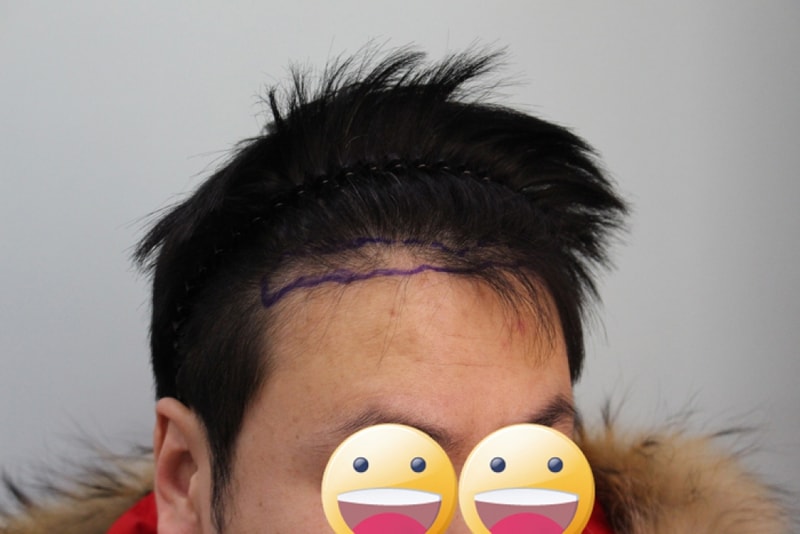 수술전1.jpg