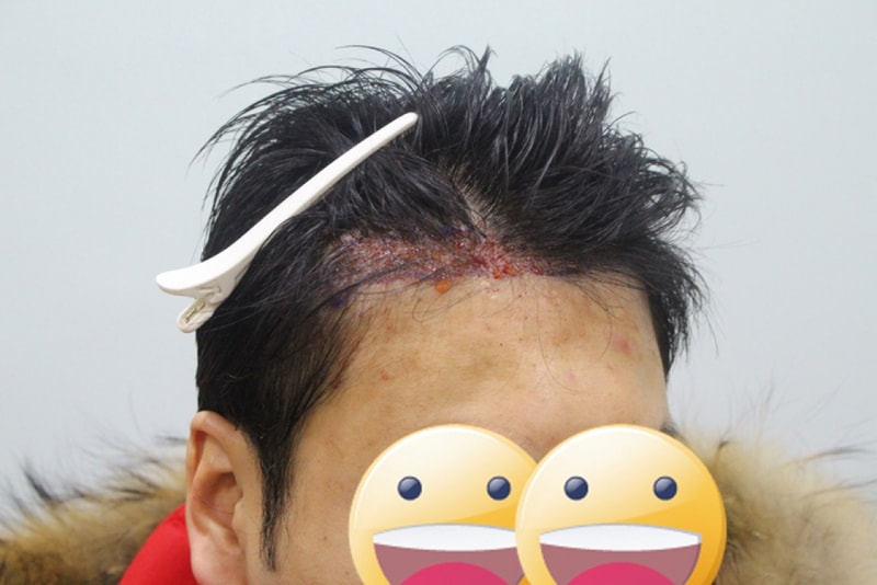 수술후1.jpg