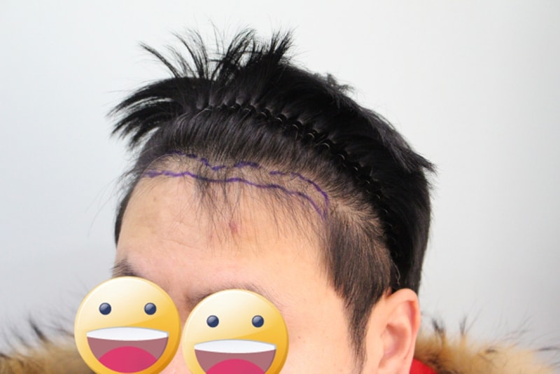 수술전2.jpg