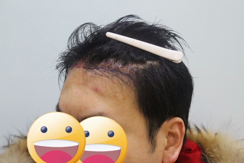 수술후2.jpg