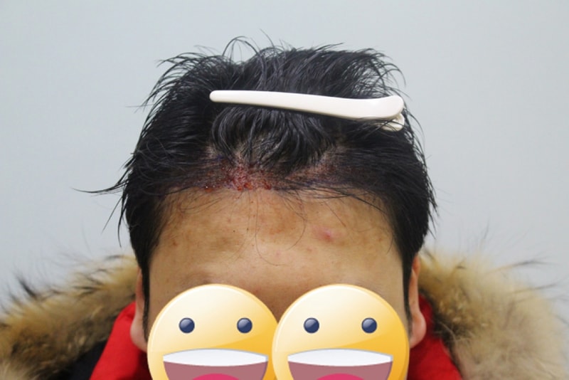 수술후3.jpg