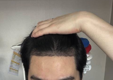 3- 생각보다 지문샴푸를 강하게 해주셔서 놀랐지만 아직 많이 빠지진 않았습니당.jpg