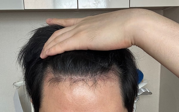 2. 꽤 많이 빠졌어요.jpg