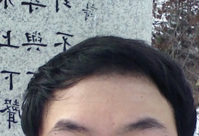 수술당일셀카2.jpg