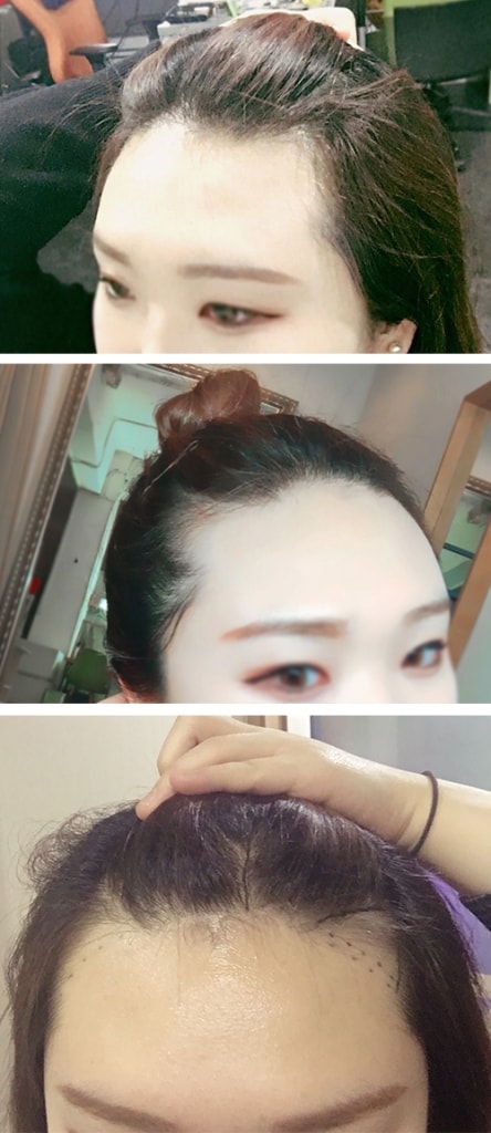 수술전.jpg
