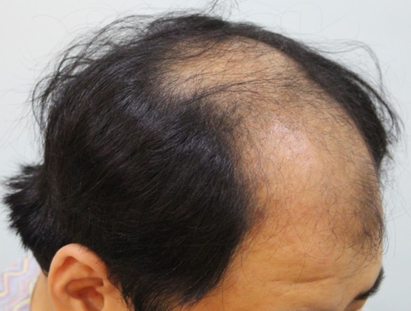 수술전2.jpg