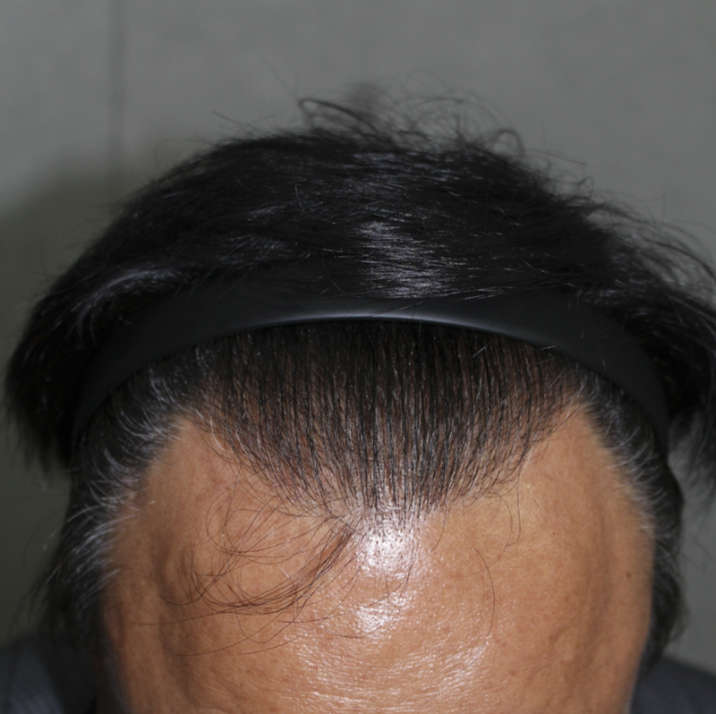 IMG_6677_9개월.png