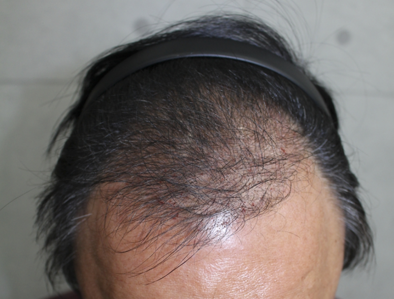IMG_4686_6개월.png
