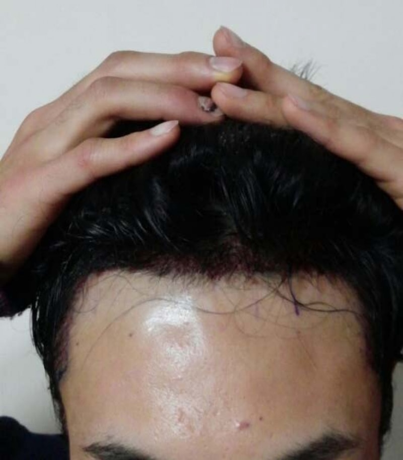 하필 수술날 날이 왜이런가요 진짜