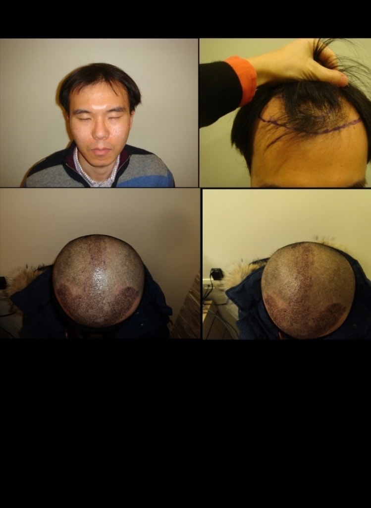 Cho_Young_Hoon_(1).jpg