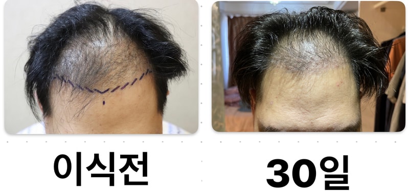 It's been three months...