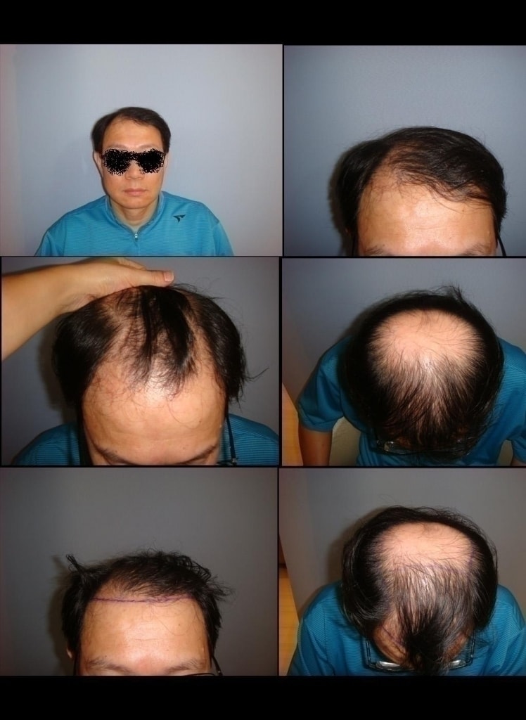 칼드나이2.JPG