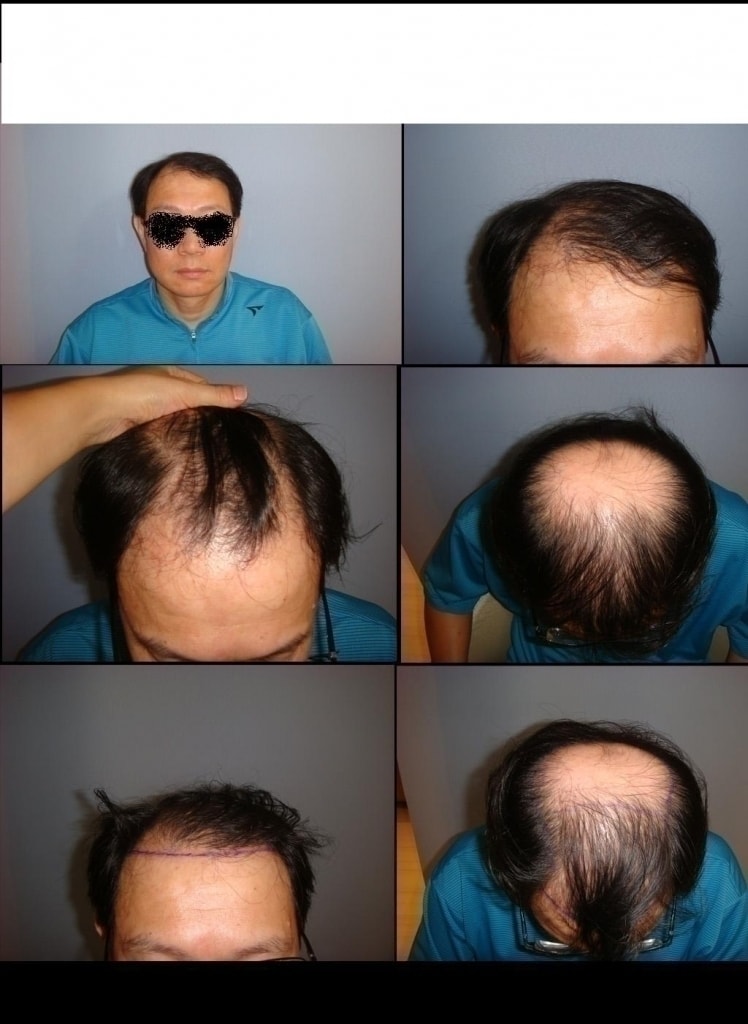 칼드나이2.JPG