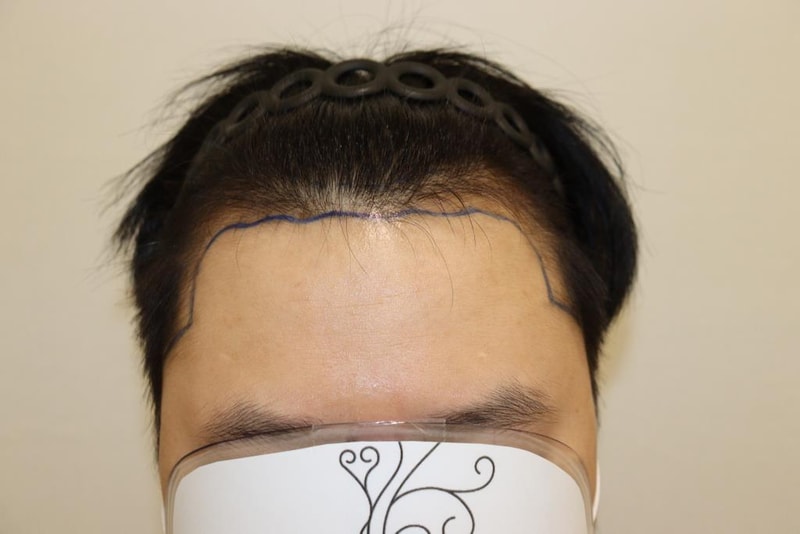 수술 당일 날 디자인 사진1.jpg