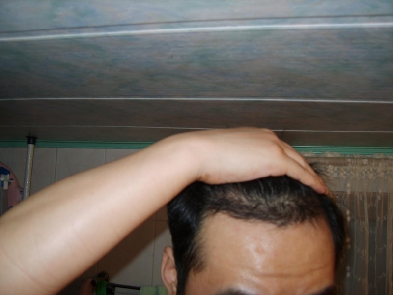 수술후2.JPG