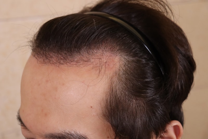 포토후기 이미지