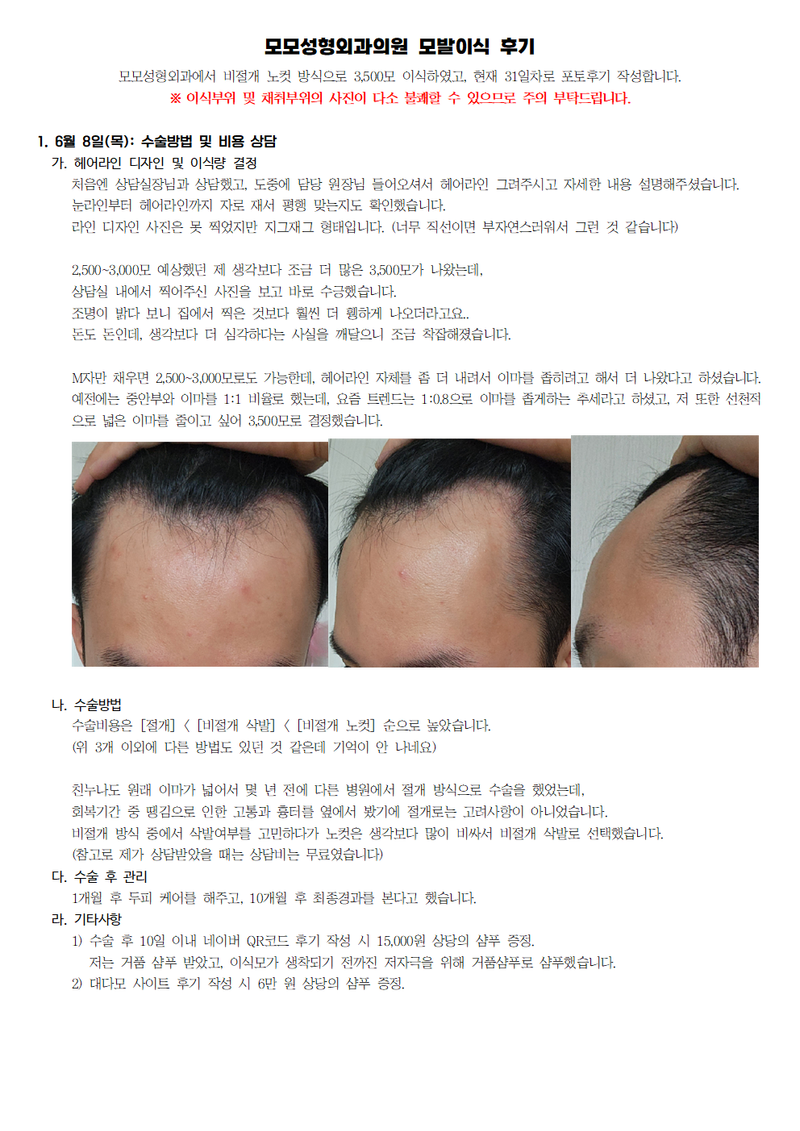 모모성형외과 모발이식 후기001.png