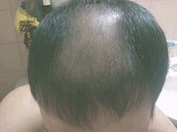 6개월10일.jpg