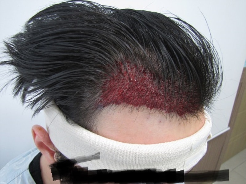 후2.jpg