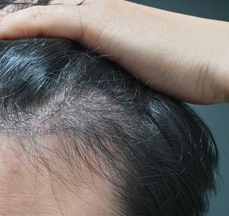 I post a review after 5 months