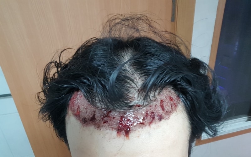 KakaoTalk_20180904_224858375.jpg