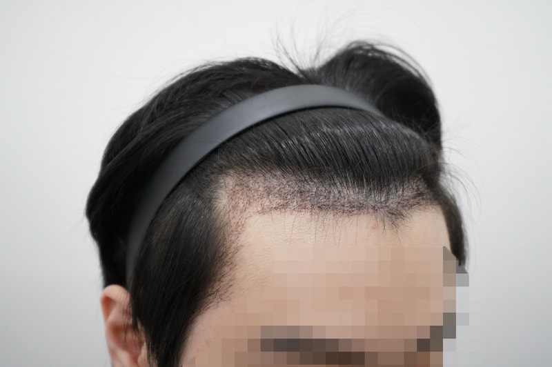 포토후기 이미지
