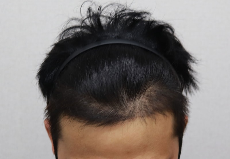 정면_4달차.jpg