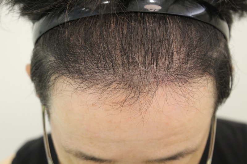 포토후기 이미지