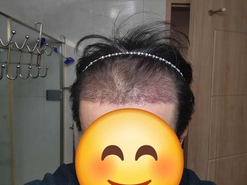 1000020315.jpg