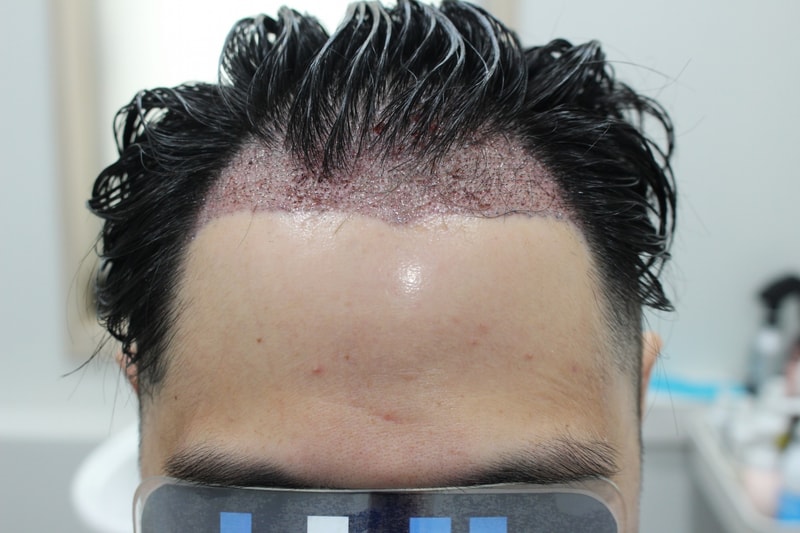 KakaoTalk_20250822_113929578_01.jpg
