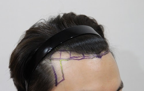 3,200 Mo~5 months~ Post-dark age review