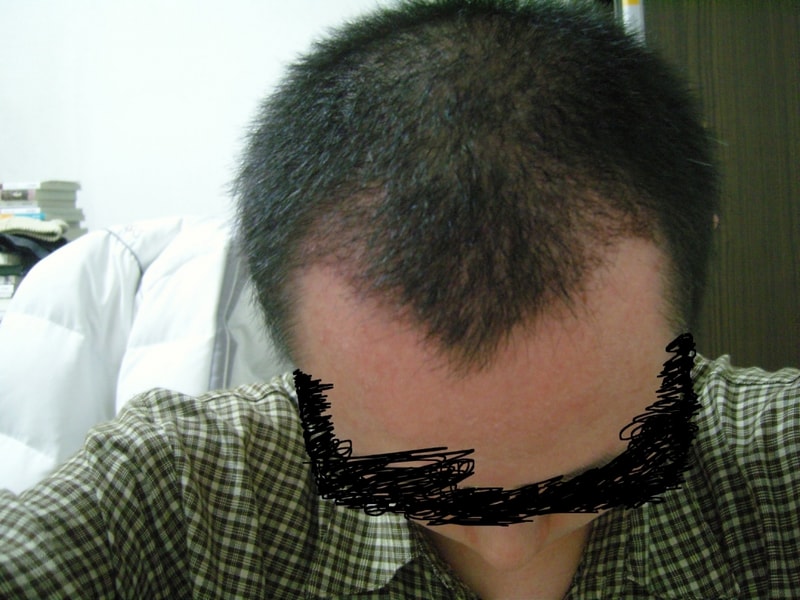 40일 모델.JPG