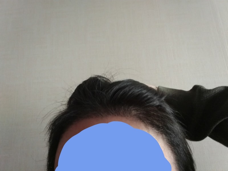 毛在成第4个月后期