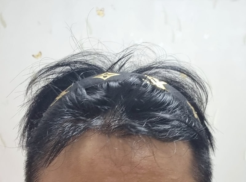 후1.jpg