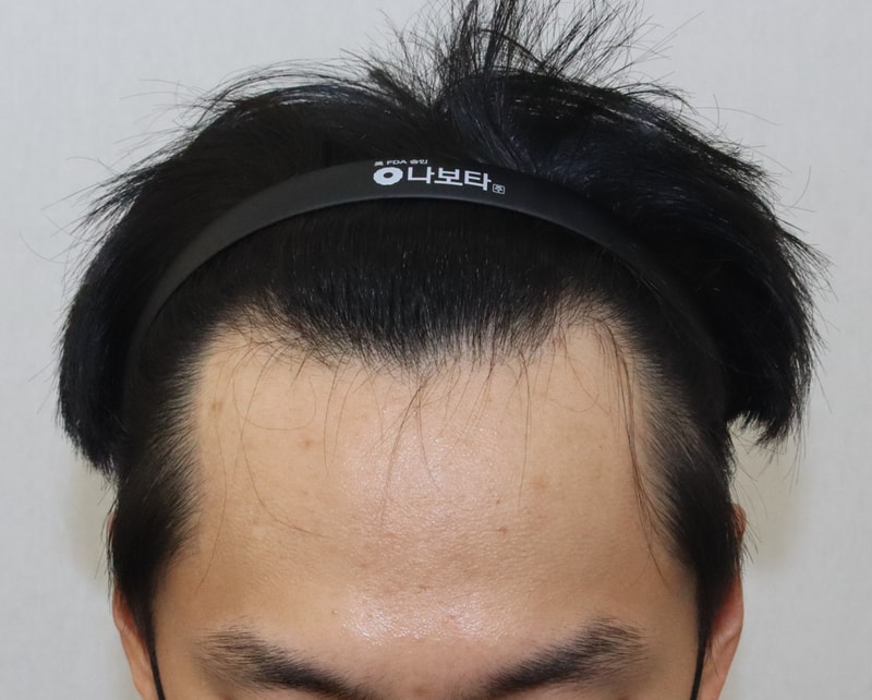 전2.jpg