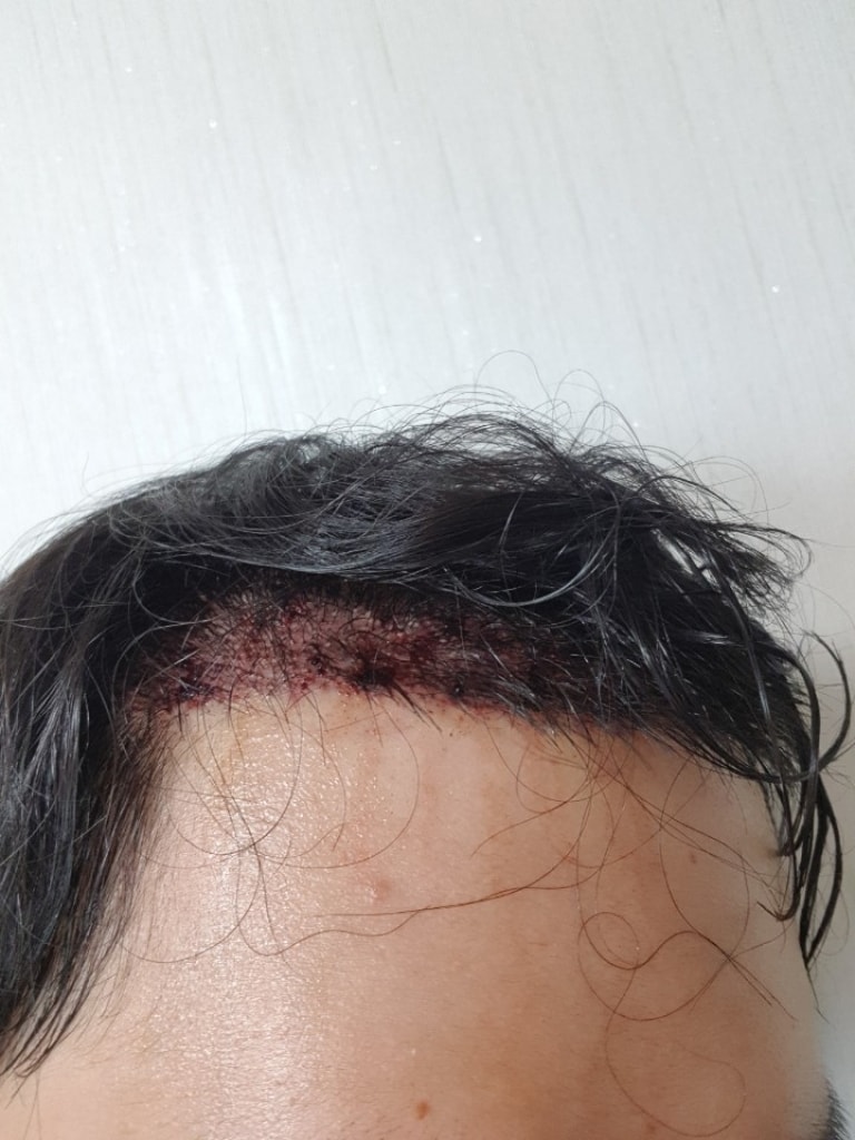 KakaoTalk_20180717_144357835.jpg